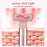 Face Eye Neck Lifting Device