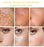 Dark Spots Remover Whitening Serum