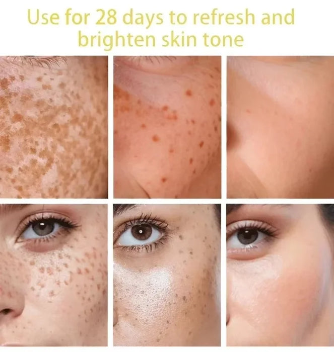 Dark Spots Remover Whitening Serum