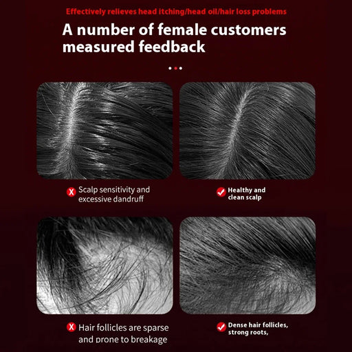 The Scalp Massaging Brush: Hair Oil Applicator for Anti-Hair Loss