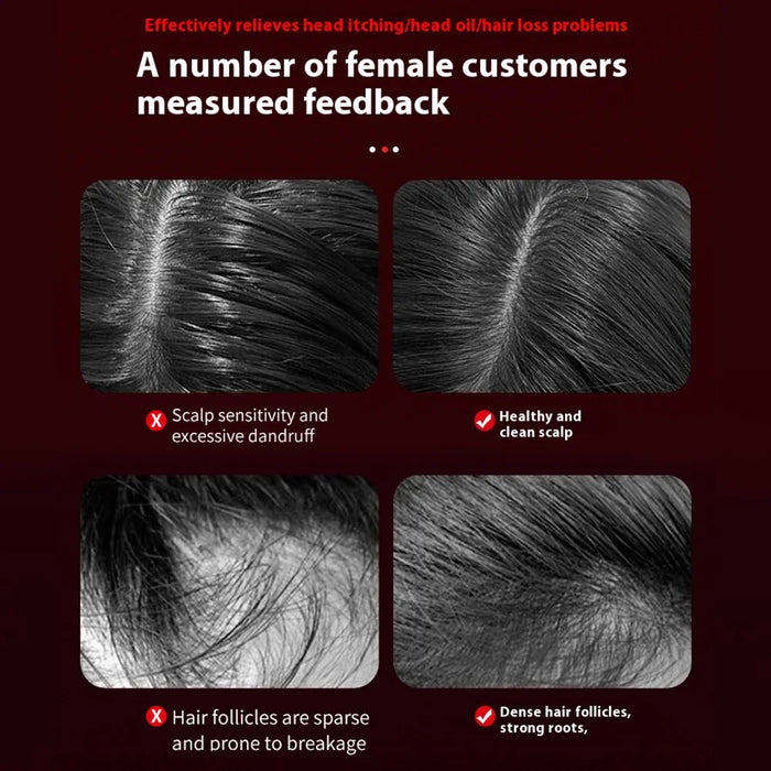The Scalp Massaging Brush: Hair Oil Applicator for Anti-Hair Loss