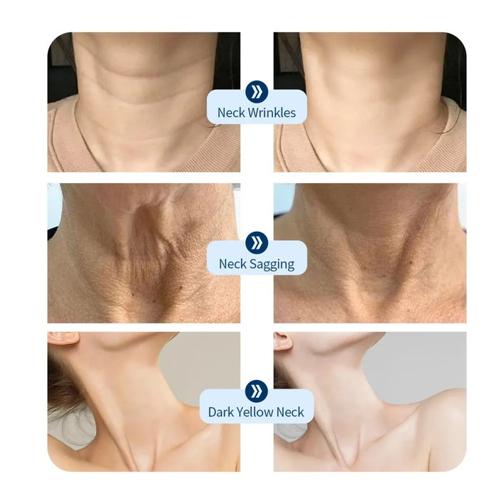 Neck LED Mask 7 Colors Photon Anti-Wrinkle