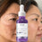 Dark Spots Remover Whitening Serum
