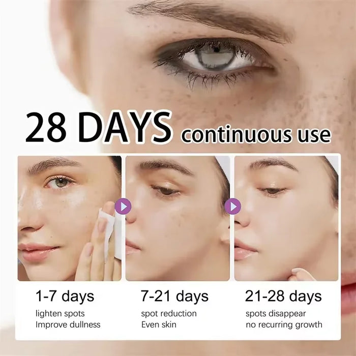 Dark Spots Remover Whitening Serum