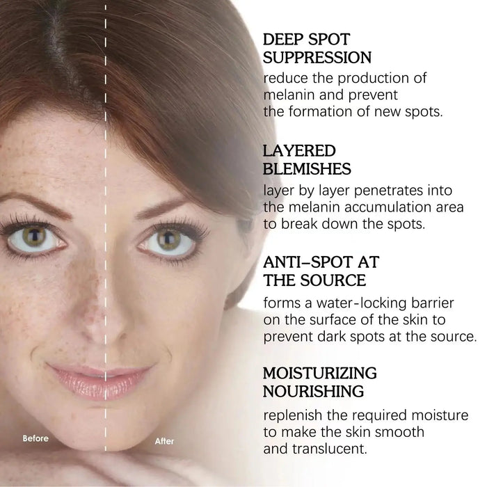 Dark Spots Remover Whitening Serum