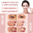 Face Eye Neck Lifting Device