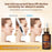 V-Line Face Slimming Lifting Device : Massager Skin Rejuvenation